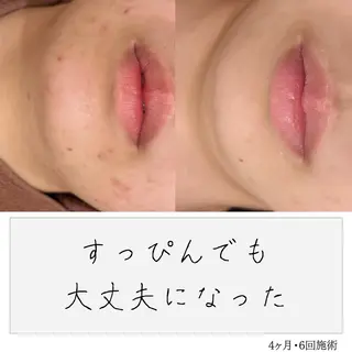 ニキビ経験者が施術 する専門サロン🌻のエステ・リラクイメージ