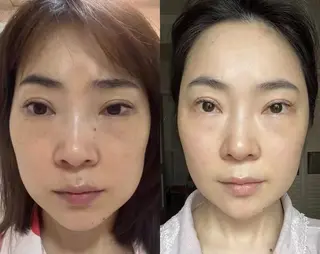 ネイル 愛維美水光専門店 川崎彩鳳のエステ・リラクイメージ