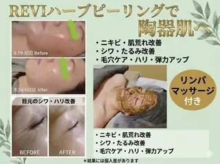 Luanaまつパ脱毛 ハーブピーリング眉毛のマツエク・マツパデザイン