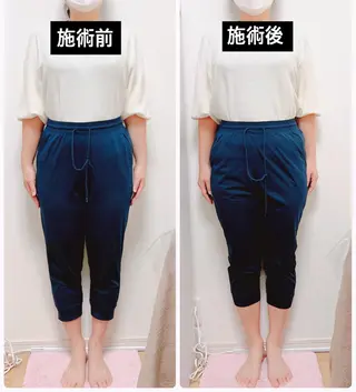 小顔と腸の専門店 ラクーラビューティーのエステ・リラクイメージ