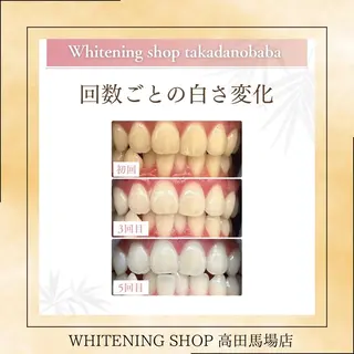 メンズ ホワイトニング ショップ高田馬場店のその他イメージ
