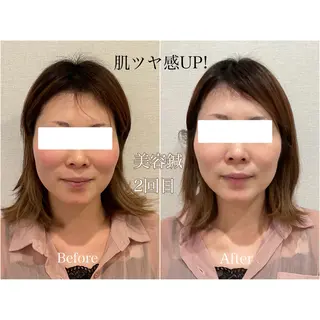けい整骨院 鍼灸院のその他イメージ