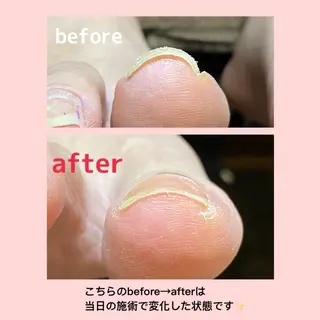 ネイル ✴︎fumi nail✴︎のネイルデザイン