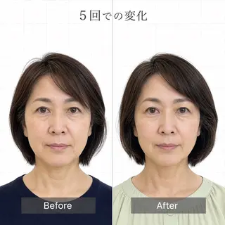 小顔・たるみ専門 DAZZLEのエステ・リラクイメージ