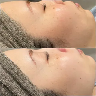 LiZA エステティックサロンのエステ・リラクイメージ
