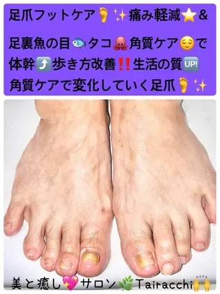 ネイル Tairacchi タイラッチのエステ・リラクイメージ