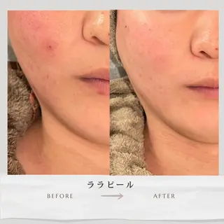 Life Salon別府店のエステ・リラクイメージ