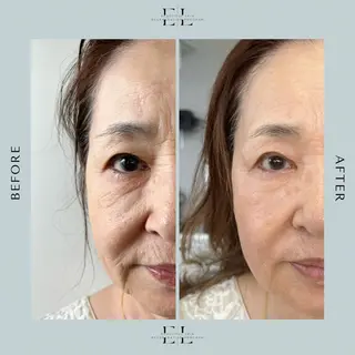 White labo 須谷のエステ・リラクイメージ