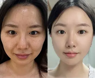 ネイル 愛維美水光専門店 川崎彩鳳のエステ・リラクイメージ