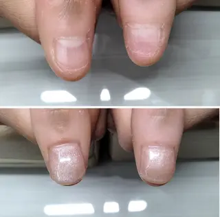 ネイル ネイルサロン アリュームのネイルデザイン