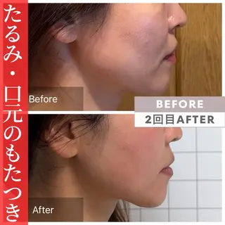 小顔矯正・美肌ケア 池田 桃花のエステ・リラクイメージ