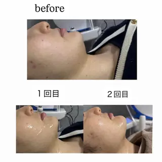 【韓国肌管理・脱毛】 クレセントのその他イメージ