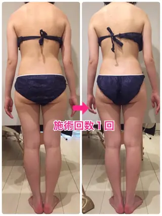 ミディアム カラー パーマ ヘアアレンジ メンズ キッズ ネイル マツエク・マツパ 痩身&ボディ 結果出し🌟丹野のエステ・リラクイメージ