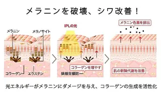 愛維美水光専門店 川崎彩鳳のエステ・リラクイメージ