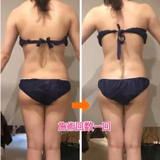 セミロング カラー パーマ ヘアアレンジ メンズ キッズ ネイル マツエク・マツパ 痩身&ボディ 結果出し🌟丹野のエステ・リラクイメージ