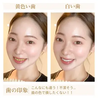 NAホワイトニング 溝の口店のエステ・リラクイメージ