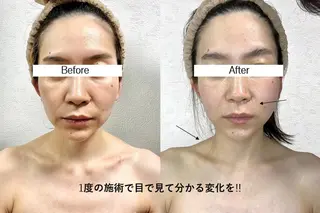 松本 富美子の眉毛・アイブロウイメージ