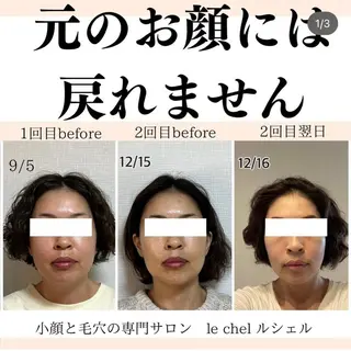 小顔・毛穴専門 ルシェルのエステ・リラクイメージ