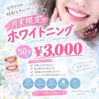 セルフ ホワイト ニングショップ立川のその他イメージ