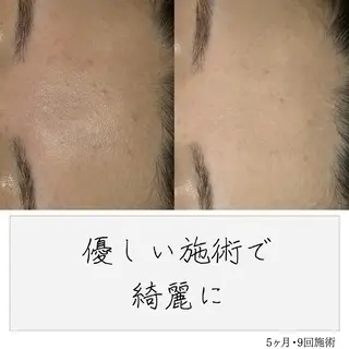 ニキビ経験者が施術 する専門サロン🌻のエステ・リラクイメージ