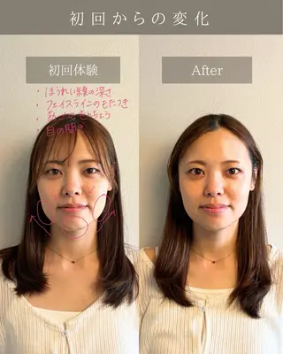 美肌&小顔矯正 Noelieのエステ・リラクイメージ