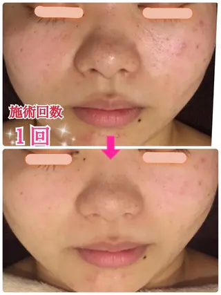ショート カラー パーマ ヘアアレンジ メンズ キッズ ネイル マツエク・マツパ 痩身&ボディ 結果出し🌟丹野のエステ・リラクイメージ