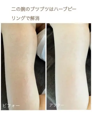 美肌❤️美眉 結果重視サロン✨のエステ・リラクイメージ