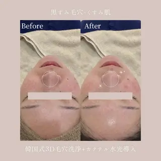 Lyséa新宿 ♡kaoriのエステ・リラクイメージ