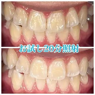 ホワイトニング🦷 ネイル💅LEAのその他イメージ
