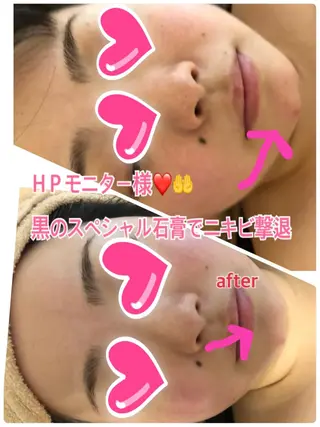 ❤️予約殺到❤️mi オールハンド痩身専門のエステ・リラクイメージ