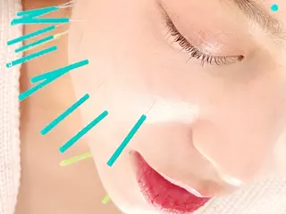 渋谷 美容鍼 首肩こり YZ先生のエステ・リラクイメージ