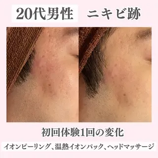 ニキビ・肌質改善専門 ♡人生が変わるサロンのエステ・リラクイメージ