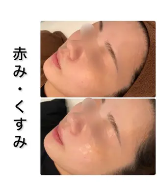 ハーブピーリング専門 BIOPLUS+川崎のエステ・リラクイメージ