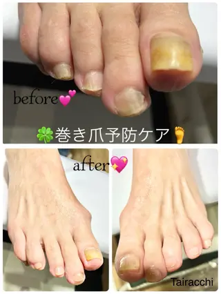 ネイル Tairacchi ﾀｲﾗｯﾁのエステ・リラクイメージ