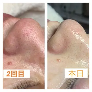 佐々木 風奈のエステ・リラクイメージ