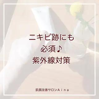 ロング カラー パーマ ヘアアレンジ メンズ キッズ ネイル マツエク・マツパ ニキビ跡専門サロン Ainaのエステ・リラクイメージ