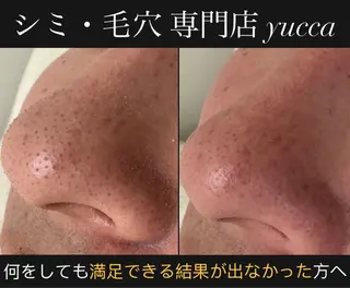寝る前に通える肌改善 専門サロンyuccaのエステ・リラクイメージ