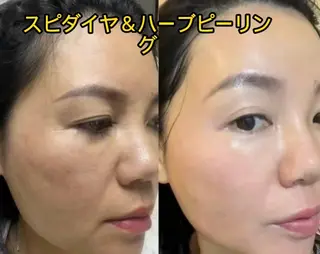 JUNA 健康美サロン渋谷店のエステ・リラクイメージ