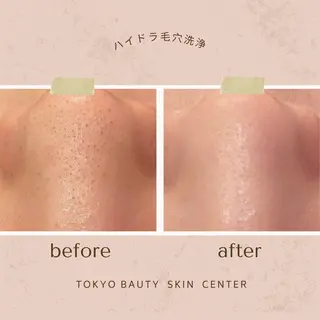 韓国肌管理& ワックス脱毛のエステ・リラクイメージ