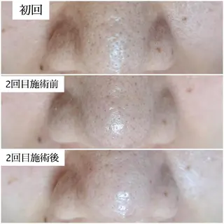 エステサロン LYSH愛名のエステ・リラクイメージ