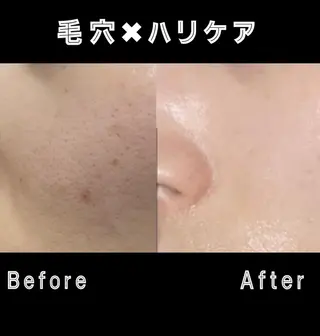 レイビス 渋谷店中野🤍のエステ・リラクイメージ