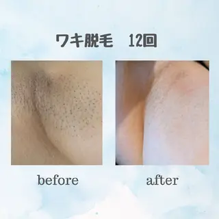 脱毛&ハーブピーリン グサロンfrereのその他イメージ