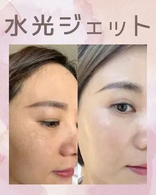 ネイル 愛維美水光専門店 川崎彩鳳のエステ・リラクイメージ