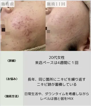 脱毛・眉毛・フェイス サロンN久留米店の眉毛・アイブロウイメージ