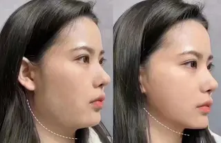 愛維美水光専門店 川崎彩鳳のエステ・リラクイメージ
