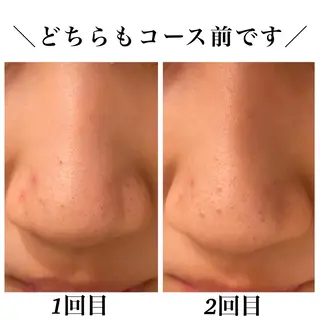 Bellesthe (ベルエステ)のエステ・リラクイメージ