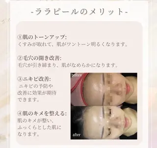 美肌毛穴ケア/看護師 🌷ナスサロmanaのエステ・リラクイメージ