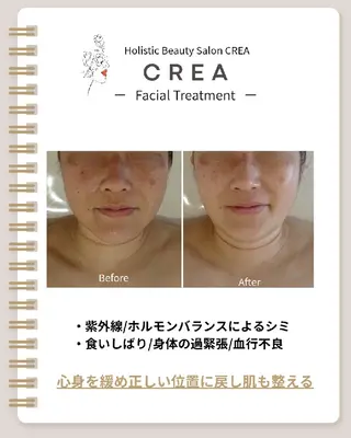 ☾⭒肌質改善|脳首肩 疲労解消CREA⭒☽のエステ・リラクイメージ