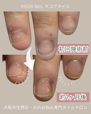 ネイル KIKOA NAIL キコアネイルのネイルデザイン