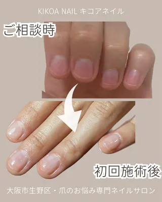 ネイル KIKOA NAIL キコアネイルのネイルデザイン
